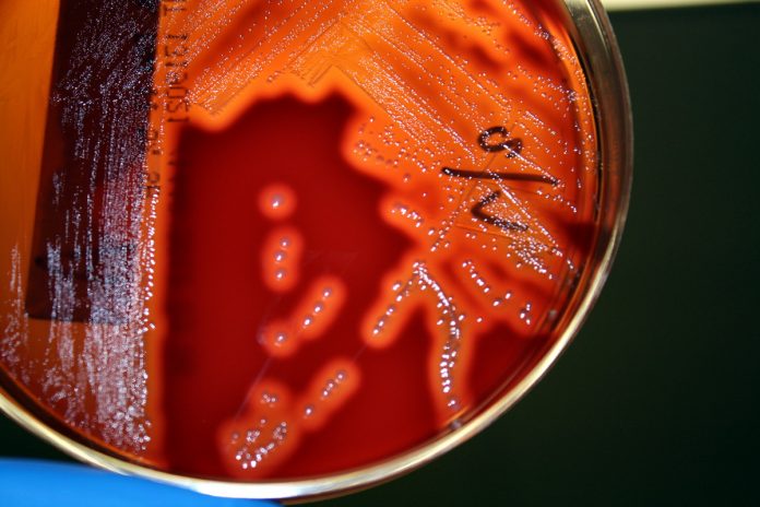 cultivo-streptococcus-pyogenes