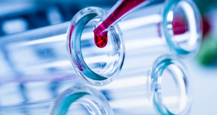 Pipette adding fluid to one of several test tubes .medical glassware.