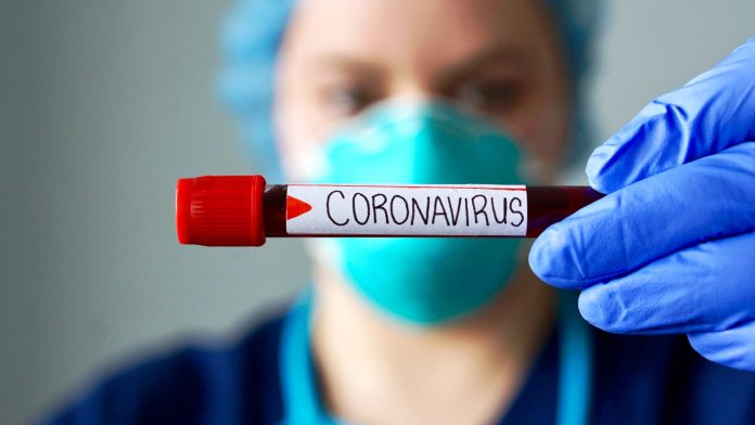 CASOS-CORONAVIRUS-